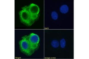 Immunofluorescence (IF) image for anti-Tumor Necrosis Factor Receptor Superfamily, Member 10b (TNFRSF10B) antibody (ABIN7072462)