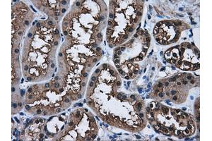 Immunohistochemical staining of paraffin-embedded Kidney tissue using anti-AKR1A1mouse monoclonal antibody. (AKR1A1 antibody)
