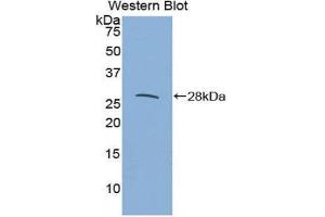 Western Blotting (WB) image for anti-Interleukin 27 Receptor, alpha (IL27RA) (AA 123-343) antibody (ABIN1859410) (IL27 Receptor alpha antibody  (AA 123-343))