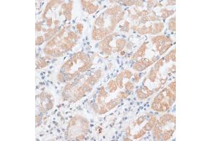 Immunohistochemistry of paraffin-embedded human stomach using PAEP antibody (ABIN6292222) at dilution of 1:100 (40x lens).