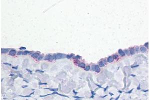 Human Ovary: Formalin-Fixed, Paraffin-Embedded (FFPE) (ENPP3 antibody  (C-Term))
