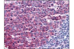 Image no. 3 for anti-Stathmin 1 (STMN1) (C-Term) antibody (ABIN374648) (Stathmin 1 antibody  (C-Term))