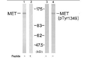 Image no. 1 for anti-Met Proto-Oncogene (MET) (pTyr1349) antibody (ABIN196990) (c-MET antibody  (pTyr1349))