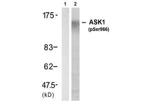 Image no. 1 for anti-Mitogen-Activated Protein Kinase Kinase Kinase 5 (MAP3K5) (pSer966) antibody (ABIN273524) (ASK1 antibody  (pSer966))