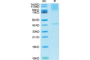 Glypican 3 Protein (GPC3) (AA 25-559) (His tag)