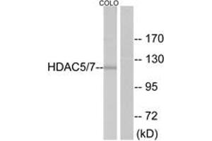 Western Blotting (WB) image for anti-Histone Deacetylase 5 (HDAC5) (AA 464-513) antibody (ABIN2888998) (HDAC5 antibody  (AA 464-513))
