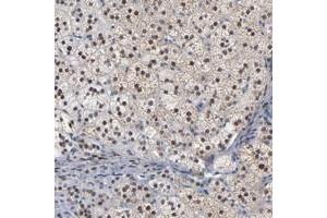 Immunohistochemical staining of human adrenal gland with FOXN2 polyclonal antibody  shows nuclear positivity in cortical cells at 1:50-1:200 dilution.