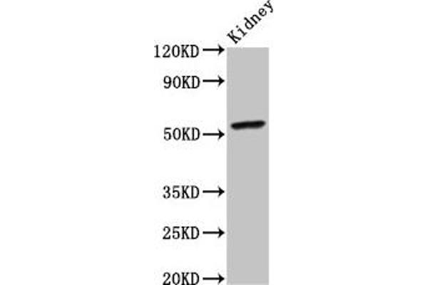CYP2C19 anticorps  (AA 245-353)