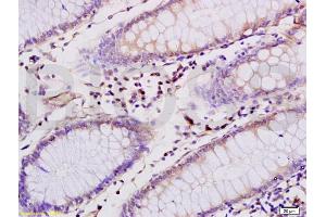 Immunohistochemistry (IHC) image for anti-CD4 (CD4) (AA 385-457) antibody (ABIN671376)