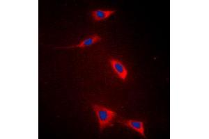 Immunofluorescent analysis of FATP5 staining in HeLa cells. (SLC27A5 antibody  (Center))