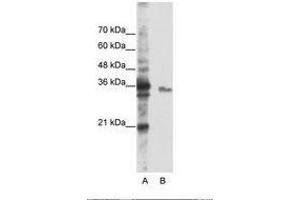 Image no. 2 for anti-Exosome Component 3 (EXOSC3) (AA 81-130) antibody (ABIN6736236) (EXOSC3 antibody  (AA 81-130))