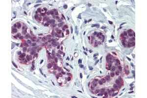 Anti-CREBBP antibody IHC of human breast. (CBP antibody  (AA 144-193))