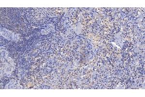 Immunohistochemistry (IHC) image for anti-Complement Component Receptor 1 (CD35) (CR1) (AA 1780-2039) antibody (ABIN7433177)