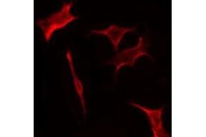 OR2M7 antibody