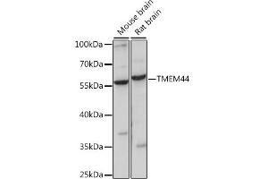 Western blot analysis of extracts of various cell lines, using TMEM44 antibody (ABIN7270964) at 1:1000 dilution. (TMEM44 antibody  (AA 110-260))