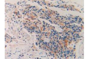 IHC-P analysis of Human Prostate Gland Tissue, with DAB staining. (MME antibody  (AA 382-538))
