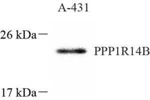 Western blot analysis of PNG (ABIN7075269),at dilution of 1: 1000 (PPP1R14B antibody)
