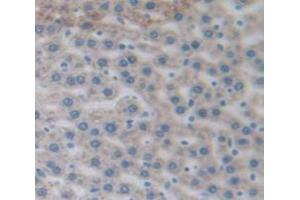 Figure. (PYGL antibody  (AA 73-267))