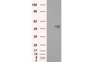 Image no. 6 for anti-Aldehyde Dehydrogenase 3 Family, Member A1 (ALDH3A1) antibody (ABIN1496591) (ALDH3A1 antibody)