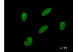 Immunofluorescence of purified MaxPab antibody to GTF2A2 on HepG2 cell.
