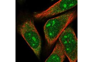 Immunofluorescent staining of RH-30 cells with ARPP-21 polyclonal antibody  (Green) shows localization to nucleoli and cytosol.