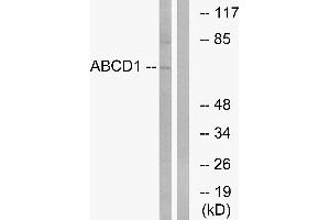 Western blot analysis of extracts from Jurkat cells, using ABCD1 antibody. (ABCD1 antibody)
