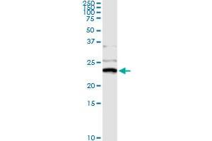 Immunoprecipitation of NME1 transfected lysate using anti-NME1 monoclonal antibody and Protein A Magnetic Bead , and immunoblotted with NME1 MaxPab rabbit polyclonal antibody. (NME1 antibody  (AA 43-152))