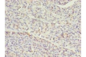 Immunohistochemistry of paraffin-embedded human pancreatic tissue using ABIN7155517 at dilution of 1:100 (SETD7 antibody  (AA 1-218))