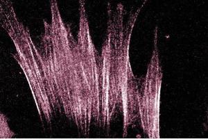 Immunofluorescence staining of human fibroblasts. (ARHGAP5 antibody  (AA 1102-1214))