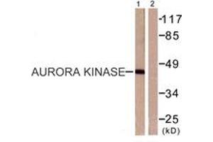 Western Blotting (WB) image for anti-Aurora Kinase A (AURKA) (AA 256-305) antibody (ABIN2888648) (Aurora A antibody  (AA 256-305))