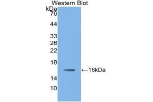 WB of Protein Standard: different control antibodies against Highly purified E. (NOS1 ELISA Kit)