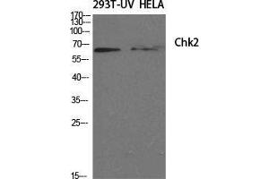 Western Blot (WB) analysis of specific cells using Chk2 Polyclonal Antibody. (CHEK2 antibody  (Tyr60))