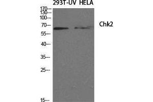 Western Blotting (WB) image for anti-Checkpoint Kinase 2 (CHEK2) (Tyr60) antibody (ABIN3183907)