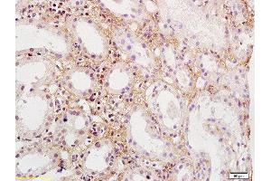 Formalin-fixed and paraffin embedded human kidney labeled with Rabbit Anti-PDGFBB Polyclonal Antibody, Unconjugated  at 1:200 followed by conjugation to the secondary antibody and DAB staining (PDGF-BB Homodimer (AA 151-241) antibody)