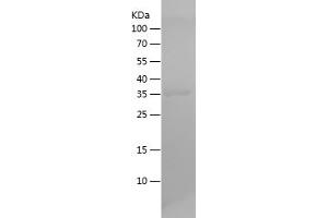 HSPE1 Protein (AA 1-102) (His-IF2DI Tag)