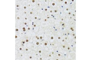 Immunohistochemistry of paraffin-embedded human liver using DDB1 Antibody (ABIN5971498) at dilution of 1/100 (40x lens). (DDB1 antibody)