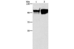 Western Blot analysis of Hela and raji cell using CD54 Polyclonal Antibody at dilution of 1:350 (ICAM1 antibody)