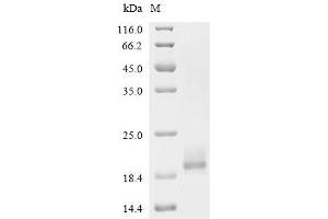 beta-2-Microglobulin (B2M) (AA 21-118), (full length) protein (His tag)