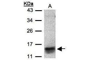 Western blot analysis of 30 ug of whole cell lysate (A:MOLT4) using a 15 % SDS PAGE gel and I309 antibody at a dilution of 1:500 (CCL1 antibody)