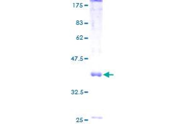 MRS2 Protein (AA 1-117) (GST tag)