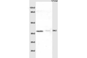 L1 rat liver lysate L2 mouse kidney lysates probed with Anti NDUFA8 Polyclonal Antibody, Unconjugated (ABIN751723) at 1:200 overnight at 4 °C. (NDUFA8 antibody  (AA 101-172))