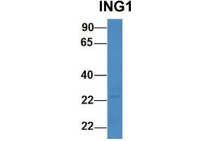 Host:  Rabbit  Target Name:  ING1  Sample Type:  Human 721_B  Antibody Dilution:  1. (ING1 antibody  (N-Term))