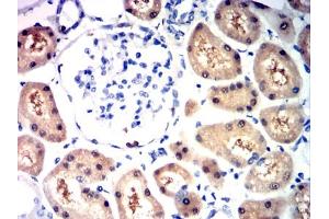 Immunohistochemical analysis of paraffin-embedded kidney tissues using HIF2a mouse mAb with DAB staining. (EPAS1 antibody  (AA 680-870))