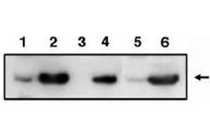 Image no. 1 for anti-Tumor Protein P53 Inducible Protein 3 (TP53I3) antibody (ABIN265005) (TP53I3 antibody)