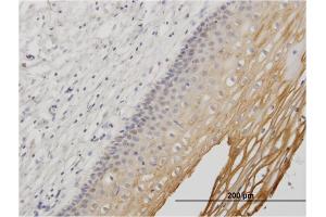 Immunostaining (ISt) image for anti-Mucin 1 (MUC1) (AA 315-420) antibody (ABIN518081)