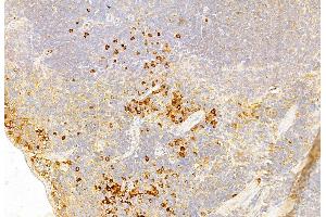 ABIN6261731 and ABIN6269136 at 1/100 staining Mouse spleen tissue by IHC-P.