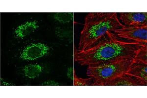 ICC/IF Image ALDH2 antibody detects ALDH2 protein at mitochondria by immunofluorescent analysis. (ALDH2 antibody  (Center))