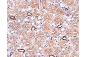 Immunohistochemistry (IHC) image for anti-Notum Pectinacetylesterase Homolog (NOTUM) (N-Term) antibody (ABIN1031488) (NOTUM antibody  (N-Term))