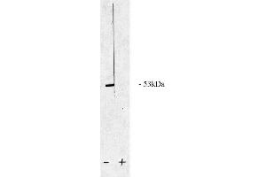 Image no. 1 for anti-Protein Phosphatase 2, Regulatory Subunit B, beta (PPP2R2B) (AA 2-14), (N-Term) antibody (ABIN264942) (PPP2R2B antibody  (N-Term))