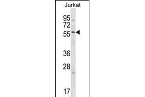 GPC3 Antibody  (cat (ABIN652202 and ABIN2840751)) western blot analysis in Jurkat cell line lysates (35 μg/lane). (Glypican 3 antibody  (C-Term))